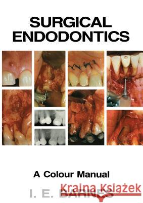 Surgical Endodontics: A Colour Manual Barnes, I. 9789401098182 Springer