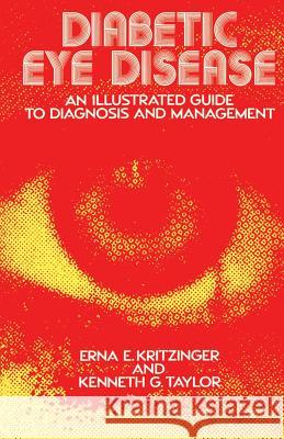 Diabetic Eye Disease: An Illustrated Guide to Diagnosis and Management Kritzinger, E. E. 9789401163460