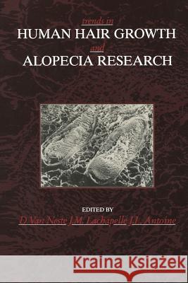 Trends in Human Hair Growth and Alopecia Research Dominique Neste J. M. LaChapelle J. L. Antoine 9789401178754