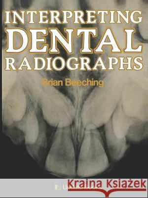 Interpreting Dental Radiographs B. W. Beeching 9789401180276 Springer