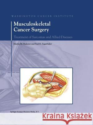 Musculoskeletal Cancer Surgery: Treatment of Sarcomas and Allied Diseases Malawer, Martin M. 9789401741620 Springer