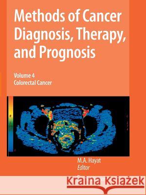 Methods of Cancer Diagnosis, Therapy, and Prognosis, Volume 4: Colorectal Cancer Hayat, M. A. 9789401777292 Springer