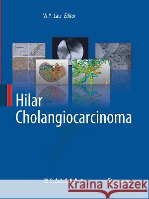 Hilar Cholangiocarcinoma W. y. Lau 9789401781718 Springer