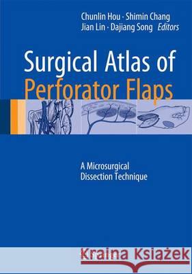 Surgical Atlas of Perforator Flaps: A Microsurgical Dissection Technique Hou, Chunlin 9789401798334 Springer