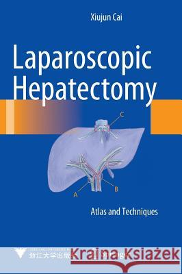 Laparoscopic Hepatectomy: Atlas and Techniques Cai, Xiujun 9789401798396 Springer