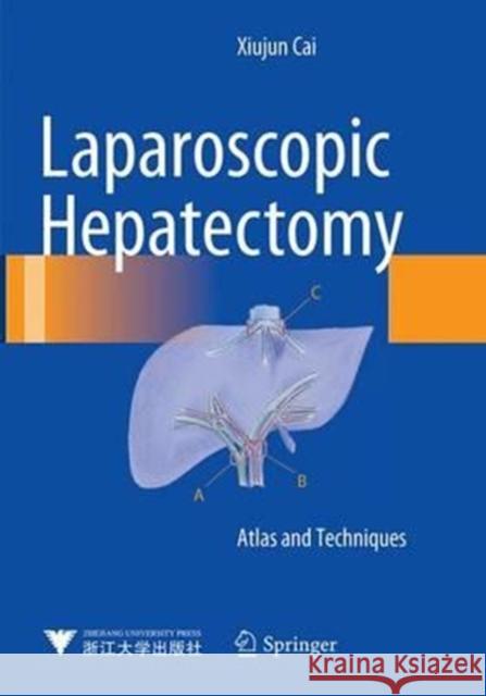Laparoscopic Hepatectomy: Atlas and Techniques Cai, Xiujun 9789402404081 Springer