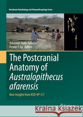 The Postcranial Anatomy of Australopithecus Afarensis: New Insights from Ksd-Vp-1/1 Haile-Selassie, Yohannes 9789402413472 Springer