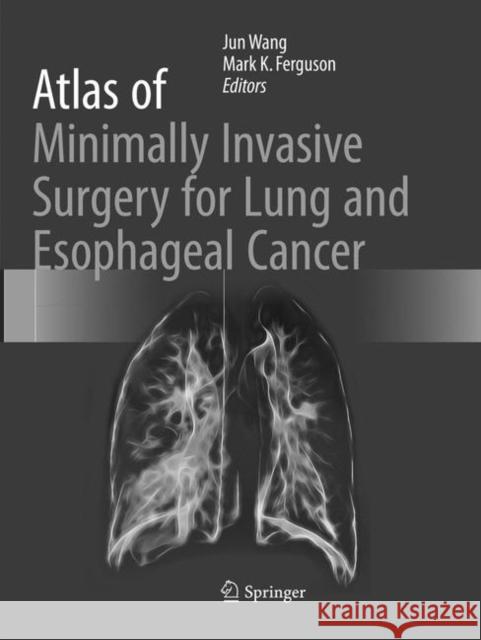 Atlas of Minimally Invasive Surgery for Lung and Esophageal Cancer Jun Wang Mark K 9789402414141