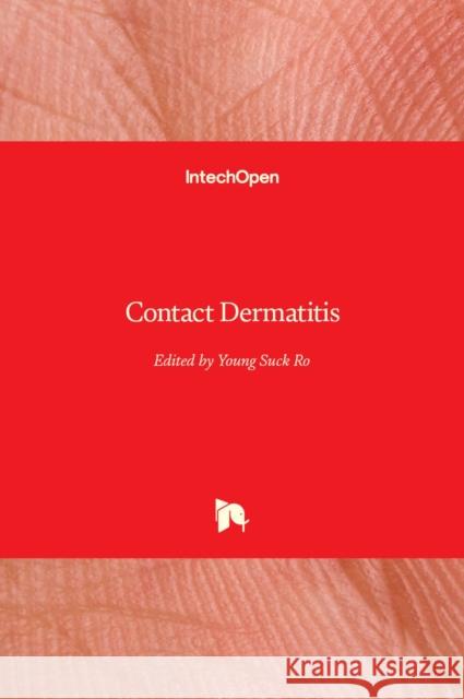 Contact Dermatitis Young Suck Ro 9789533075778