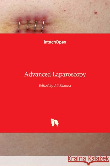 Advanced Laparoscopy Ali Shamsa 9789533076744 Intechopen