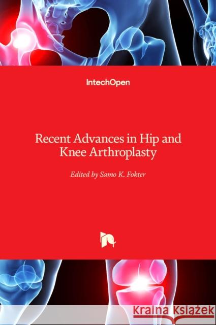 Recent Advances in Hip and Knee Arthroplasty Samo Fokter 9789533078410 Intechopen