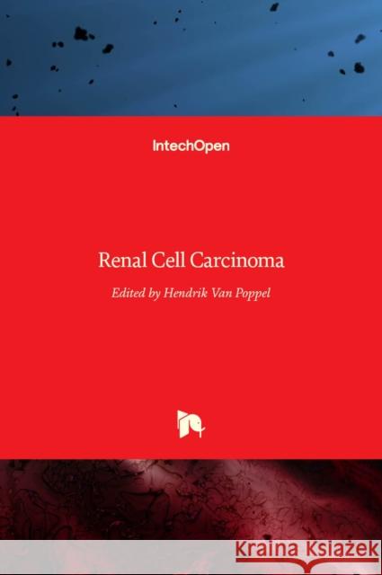 Renal Cell Carcinoma Hendrik Va 9789533078441 Intechopen