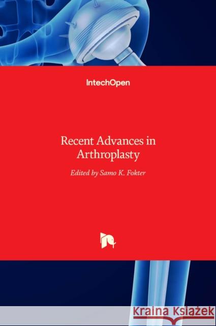 Recent Advances in Arthroplasty Samo Fokter 9789533079905 Intechopen