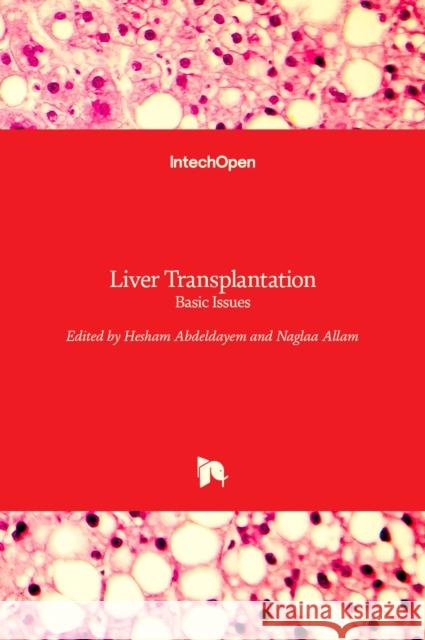 Liver Transplantation: Basic Issues Naglaa Allam Hesham Abdeldayem 9789535100164