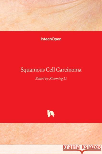 Squamous Cell Carcinoma Xiaoming Li 9789535100249