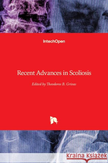 Recent Advances in Scoliosis Theodoros Grivas 9789535105954 Intechopen
