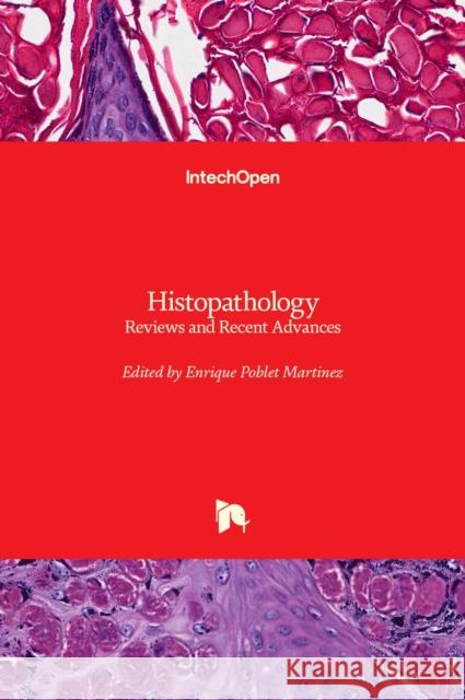 Histopathology: Reviews and Recent Advances Enrique Poblet 9789535108665 Intechopen