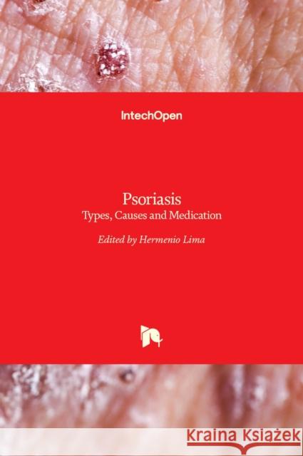 Psoriasis: Types, Causes and Medication Hermenio Lima 9789535110651 Intechopen