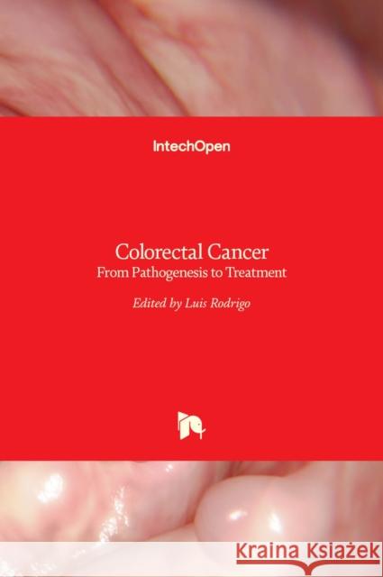 Colorectal Cancer: From Pathogenesis to Treatment Luis Rodrigo 9789535125440