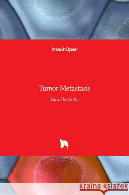 Tumor Metastasis Ke Xu 9789535126300 Intechopen