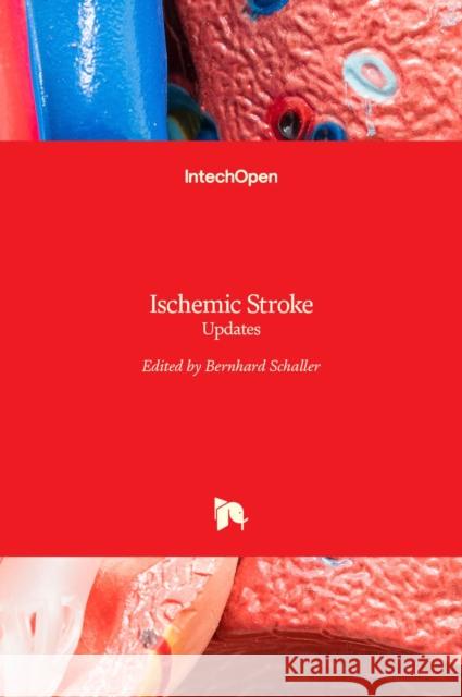 Ischemic Stroke: Updates Bernhard Schaller 9789535127123 Intechopen