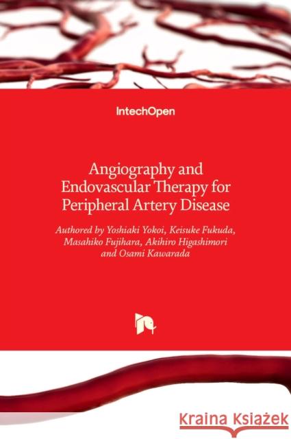 Angiography and Endovascular Therapy for Peripheral Artery Disease Yoshiaki Yokoi, Keisuke Fukuda, Masahiko Fujihara, Akihiro Higashimori, Osami Kawarada 9789535129677