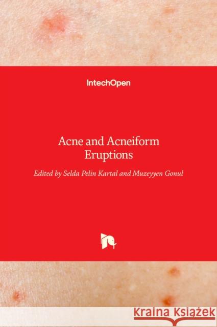 Acne and Acneiform Eruptions Selda Pelin Kartal M 9789535129899 Intechopen