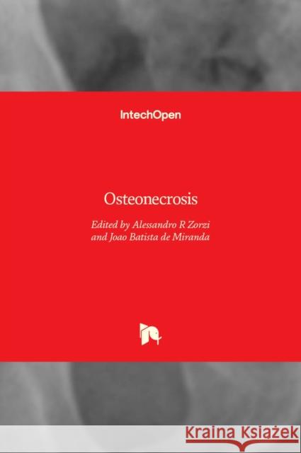 Osteonecrosis Alessandro Rozim Zorzi Joao Batista de Miranda  9789535133070