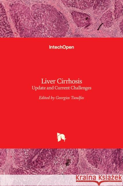 Liver Cirrhosis: Update and Current Challenges Georgios Tsoulfas 9789535133094 Intechopen
