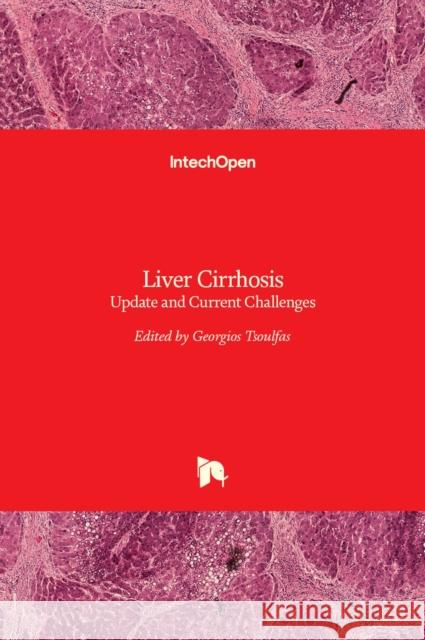 Liver Cirrhosis: Update and Current Challenges Georgios Tsoulfas 9789535133094