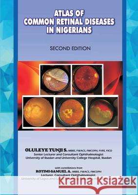 The Atlas of Retinal Diseases in Nigerians Oluleye S. Tunji 9789789212088 Book Builders Editions Africa