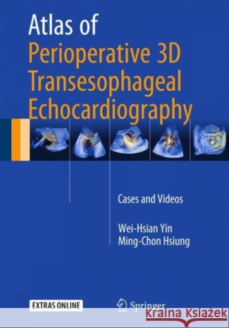 Atlas of Perioperative 3D Transesophageal Echocardiography: Cases and Videos Yin, Wei-Hsian 9789811005862 Springer