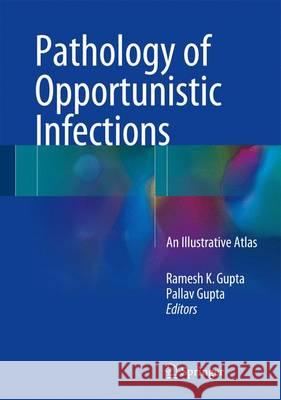 Pathology of Opportunistic Infections: An Illustrative Atlas Gupta, Ramesh K. 9789811016684 Springer