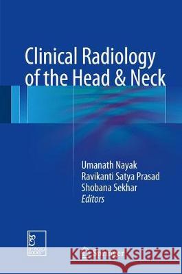 Clinical Radiology of Head and Neck Tumors Umanath Nayak Ravikanti Saty Shobana Sekhar 9789811050343 Springer