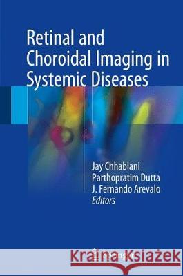 Retinal and Choroidal Imaging in Systemic Diseases Jay Chhablani Parthopratim Dutta Majumder J. Fernando Arevalo 9789811054594