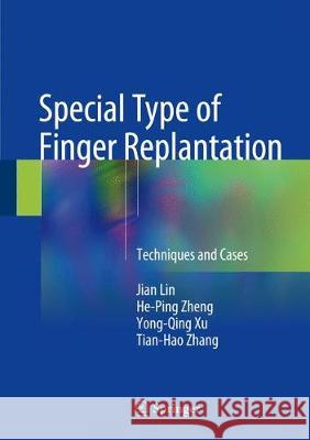 Special Type of Finger Replantation: Techniques and Cases Lin, Jian 9789811062285 Springer