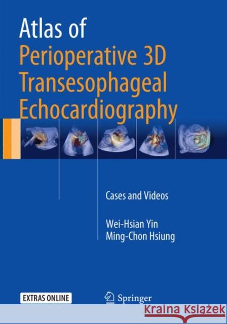 Atlas of Perioperative 3D Transesophageal Echocardiography: Cases and Videos Yin, Wei-Hsian 9789811092022 Springer