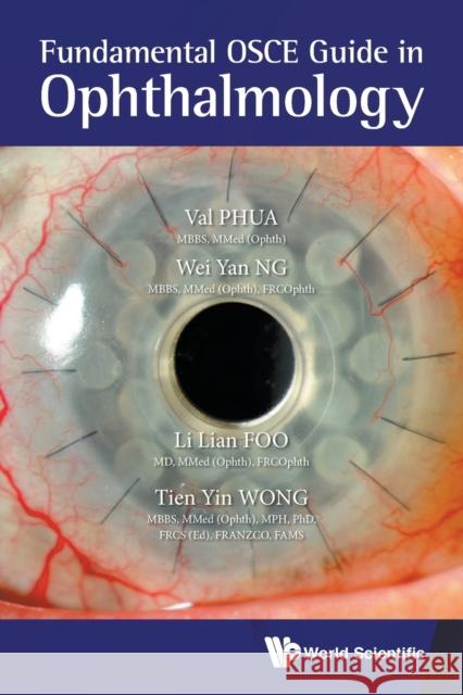 Fundamental OSCE Guide in Ophthalmology Val Jun Rong Phua Li Lian Foo Wei Yan Ng 9789811201448 World Scientific Publishing Company