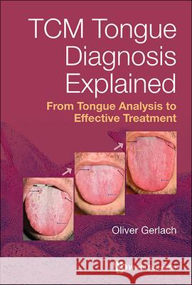 Tcm Tongue Diagnosis Explained Oliver Gerlach 9789811297359