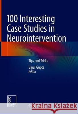 100 Interesting Case Studies in Neurointervention: Tips and Tricks Gupta, Vipul 9789811313455