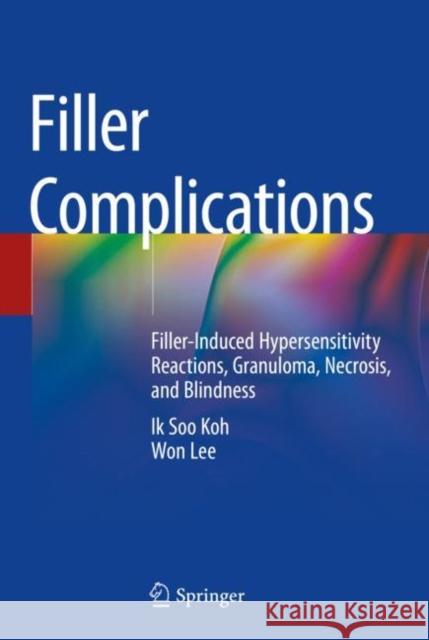 Filler Complications: Filler-Induced Hypersensitivity Reactions, Granuloma, Necrosis, and Blindness Koh, Ik Soo 9789811366383 Springer