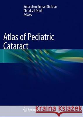 Atlas of Pediatric Cataract Sudarshan Kumar Khokhar Chirakshi Dhull 9789811369384