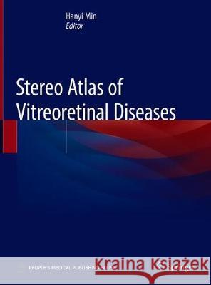 Stereo Atlas of Vitreoretinal Diseases Hanyi Min 9789811383984 Springer