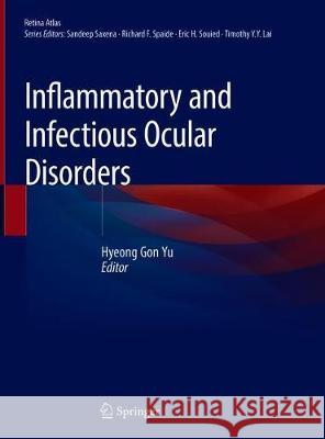 Inflammatory and Infectious Ocular Disorders Hyeong Gon Yu 9789811385452 Springer