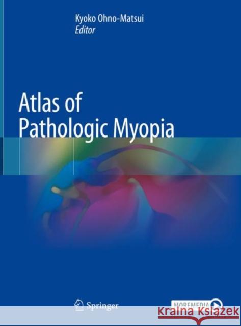 Atlas of Pathologic Myopia Kyoko Ohno-Matsui 9789811542602