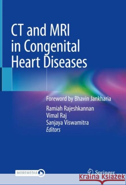 CT and MRI in Congenital Heart Diseases Ramiah Rajeshkannan Vimal Raj Sanjaya Viswamitra 9789811567544