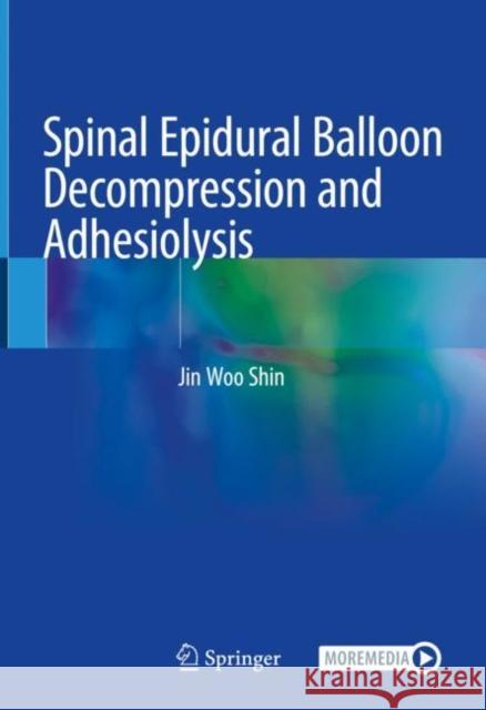 Spinal Epidural Balloon Decompression and Adhesiolysis Jin Woo Shin 9789811572647 Springer