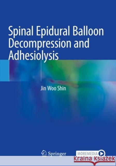 Spinal Epidural Balloon Decompression and Adhesiolysis Shin, Jin Woo 9789811572678 Springer Singapore