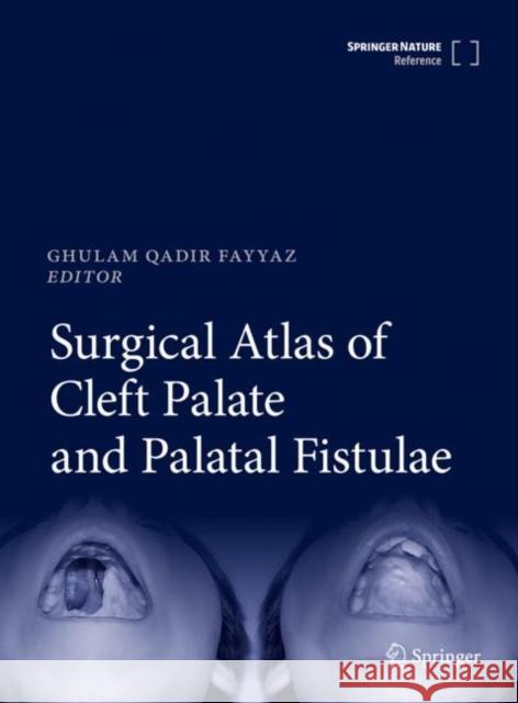 Surgical Atlas of Cleft Palate and Palatal Fistulae Ghulam Qadir Fayyaz 9789811581236 Springer