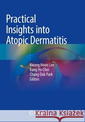 Practical Insights Into Atopic Dermatitis Lee, Kwang Hoon 9789811581618